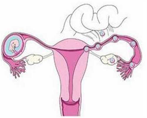 浙江代孕中介，浙江代孕的联系方式，什么是前置胎盘